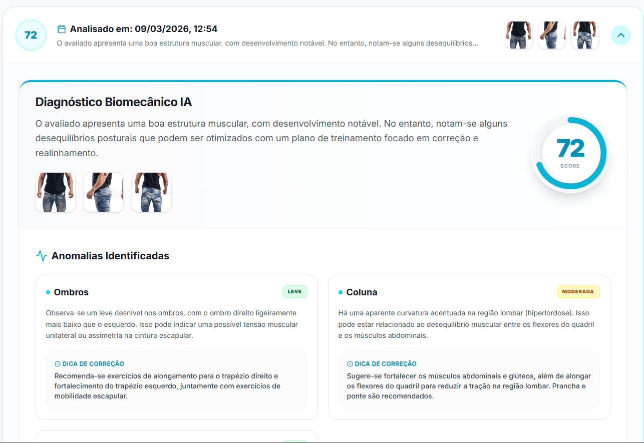 Análise de Assimetria